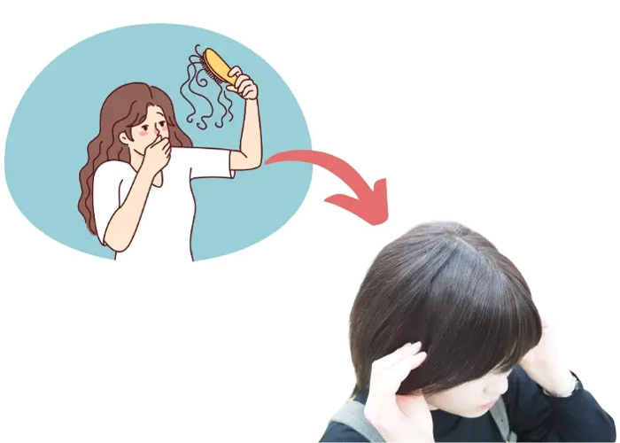 抜け毛・脱毛とウィッグ