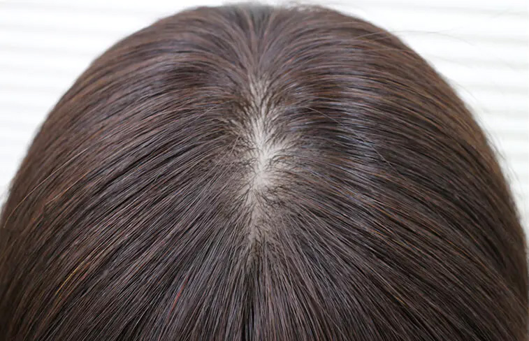 医療用ウィッグ/シルクタッチワイドつむじ 医療用ウィッグ/シルクタッチワイドつむじ