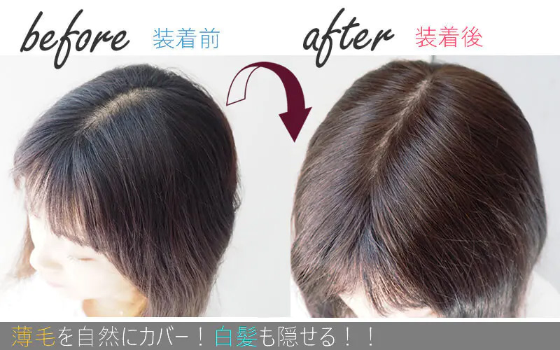 通気性抜群のシルクタッチスキン皮膚/ヘアピース/つむじ