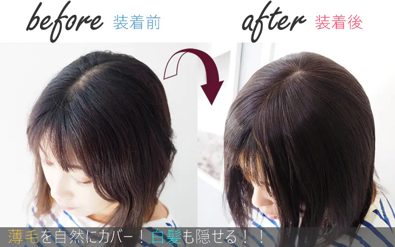 通気性リアルスキンワイド/ヘアピース/つむじ