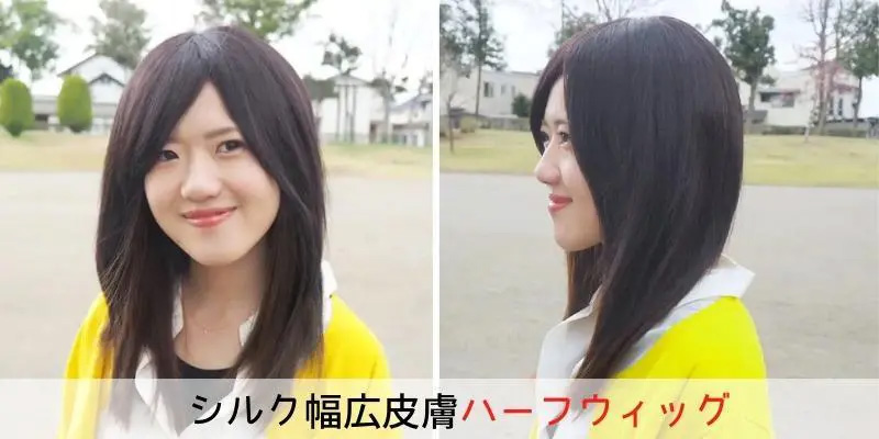 円形脱毛症/結婚式