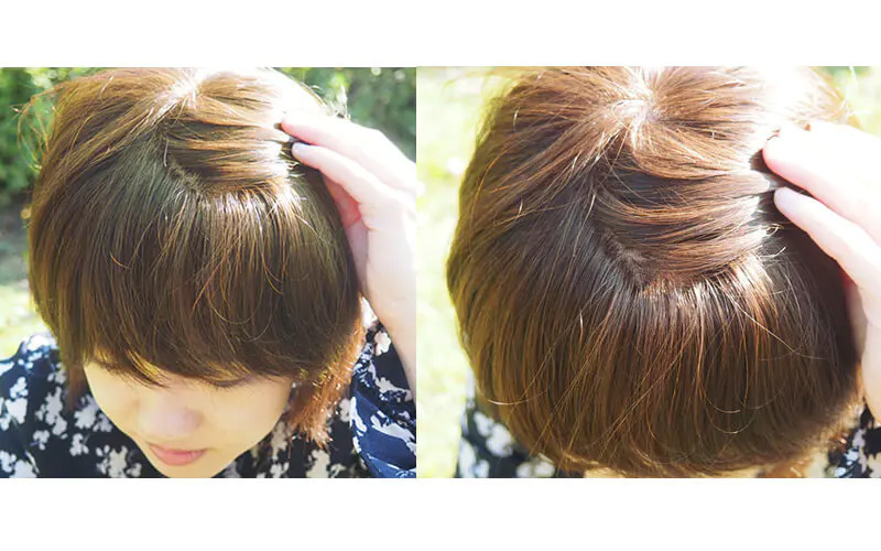 医療用ウィッグ/毛量は少なめがいいのか、多めがいいのか