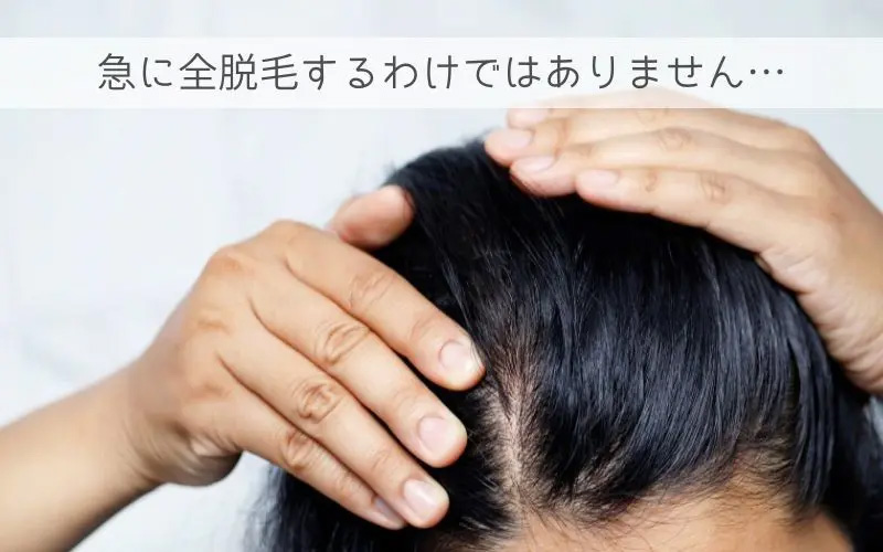 抗がん剤脱毛の期間