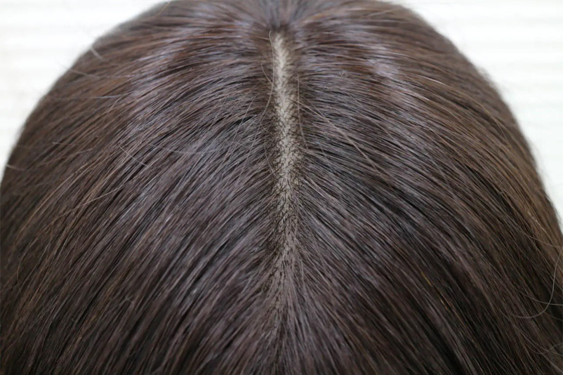 子供用 医療用ウィッグ/ウレタン皮膚