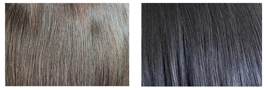 医療用ウィッグの人毛100%とミックス毛