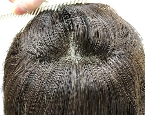 医療用ウィッグのつむじ