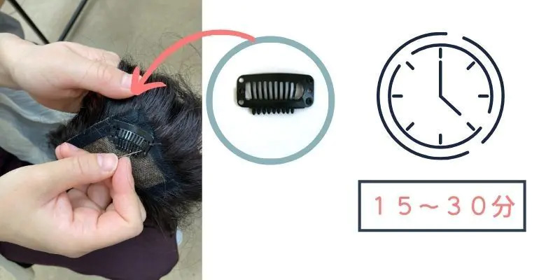 医療用ウィッグのウィッグピン取り付け時間 医療用ウィッグのウィッグピン取り付け時間