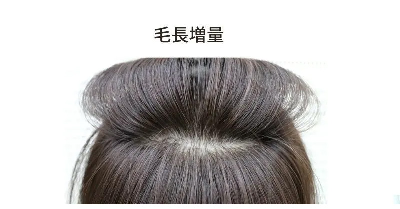 医療用ウィッグ/毛長増量