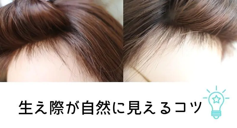 医療用ウィッグ/生え際が自然に見えるコツ