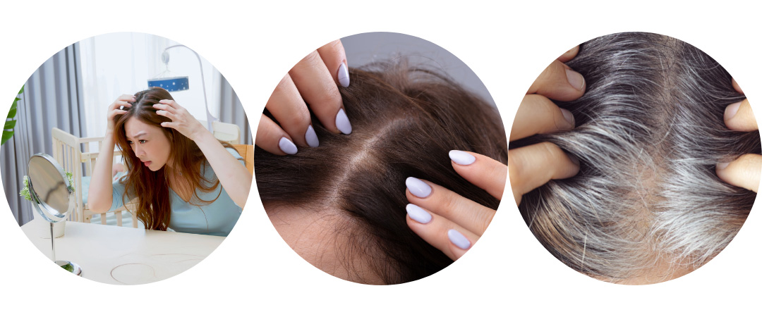 ヘアピース/こんな悩みの方へ/白髪・脱毛 ヘアピース/こんな悩みの方へ/白髪・脱毛