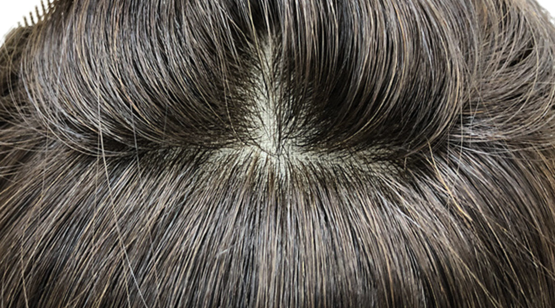 ヘアピース/ふんわり髪つむじ ヘアピース/ふんわり髪つむじ