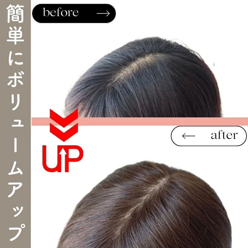 ヘアピース/ボリュームアップ ヘアピース/ボリュームアップ