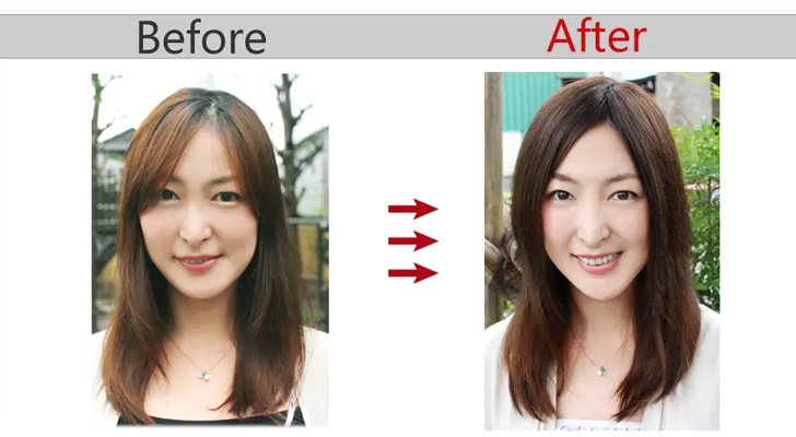 ヘアピース「ふんわり髪つむじ Sサイズ」 - 医療用ウィッグ専門店