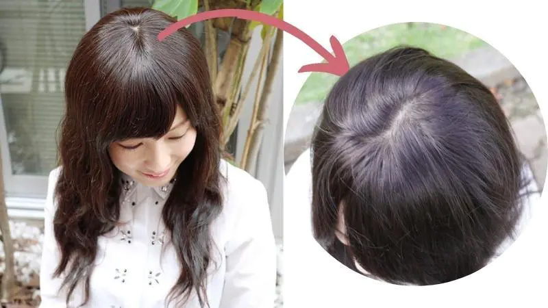 医療用ウィッグ/自然なつむじ3