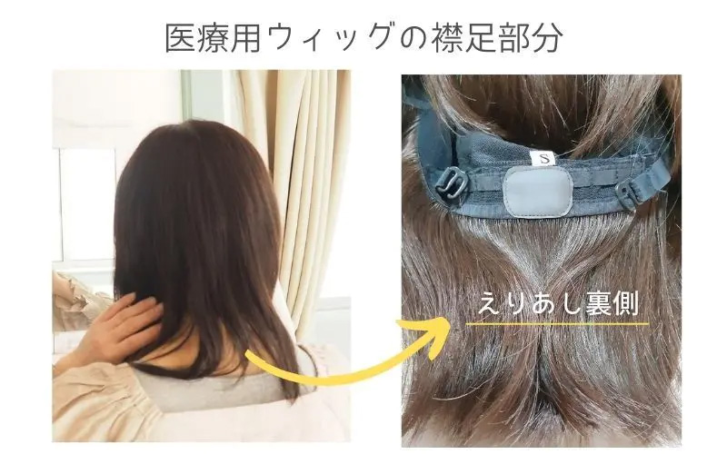 医療用ウィッグの襟足