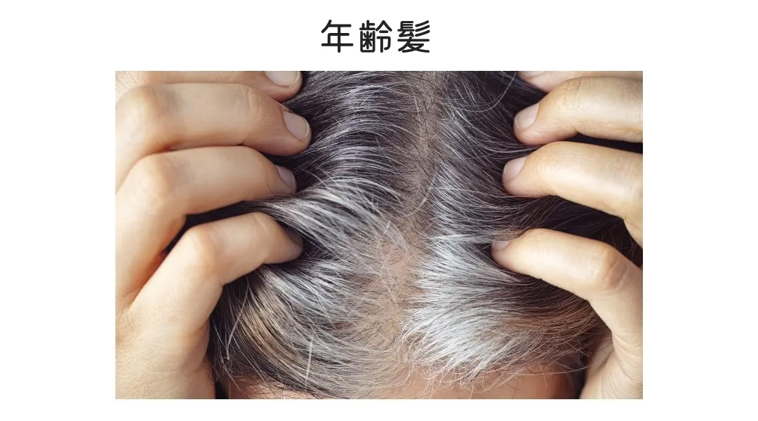 ヘアピース/年齢を感じる ヘアピース/年齢を感じる