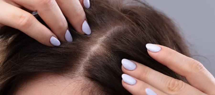 ショートヘアピース/頭頂部分のみ脱毛 ショートヘアピース/頭頂部分のみ脱毛