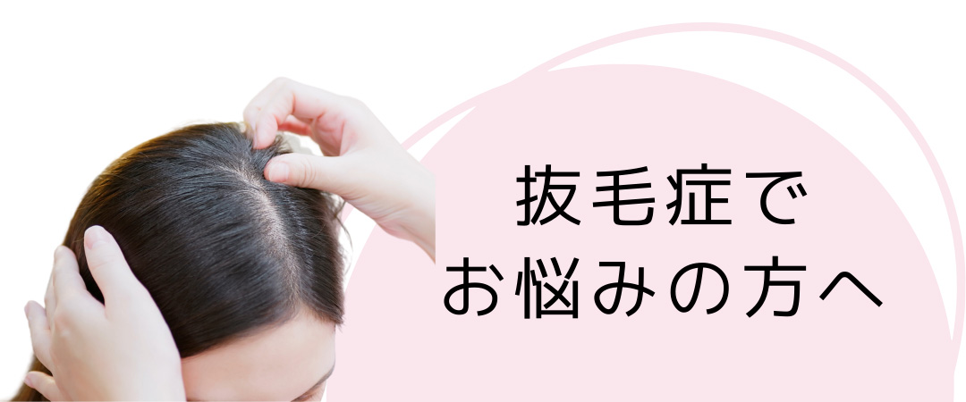 円形脱毛症