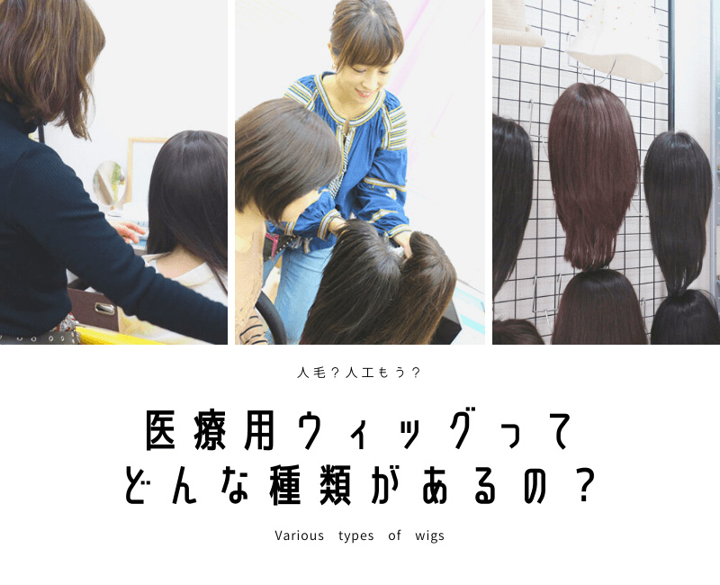 医療用ウィッグの種類