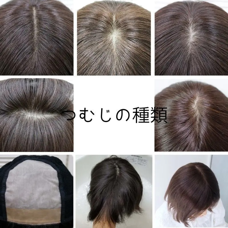 医療用ウィッグ/つむじの種類