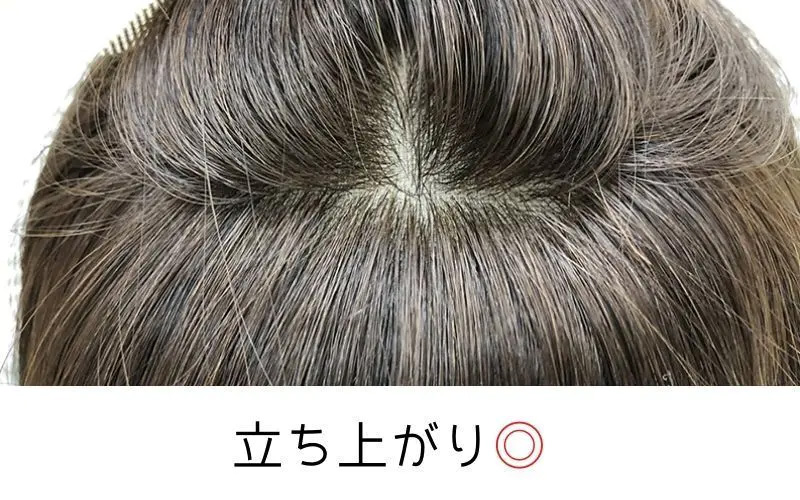 医療用ウィッグ・ふんわりリアルスキンワイド/ふんわり感