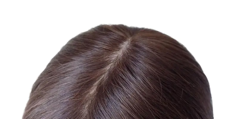 つむじとヘアピース
