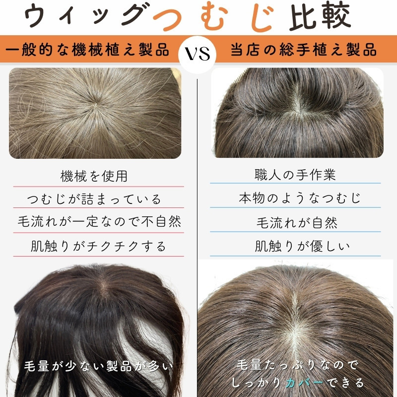 医療用ウィッグ「あっちパパ」/つむじ比較（機械植えと当店の手植え）
